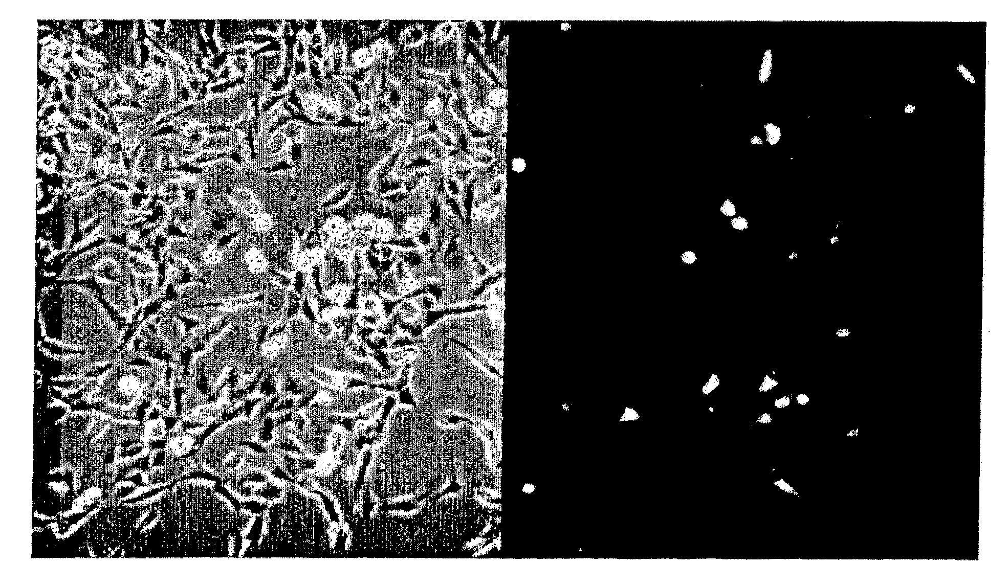 Detection of neuropeptides associated with pelvic pain disorders and uses thereof