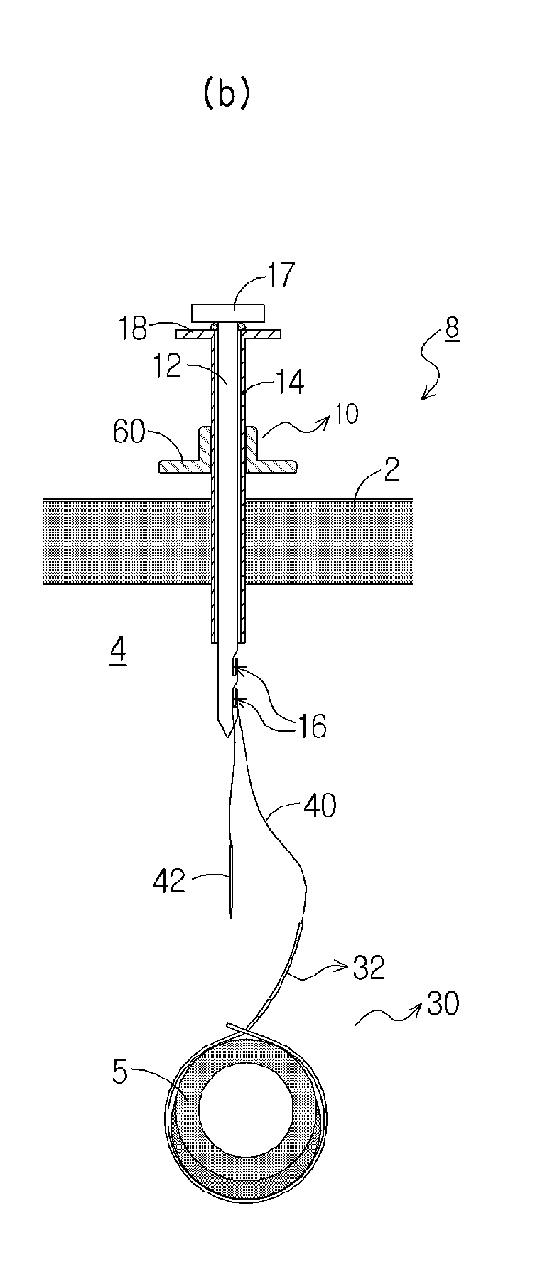 Retraction device for laparoscopy