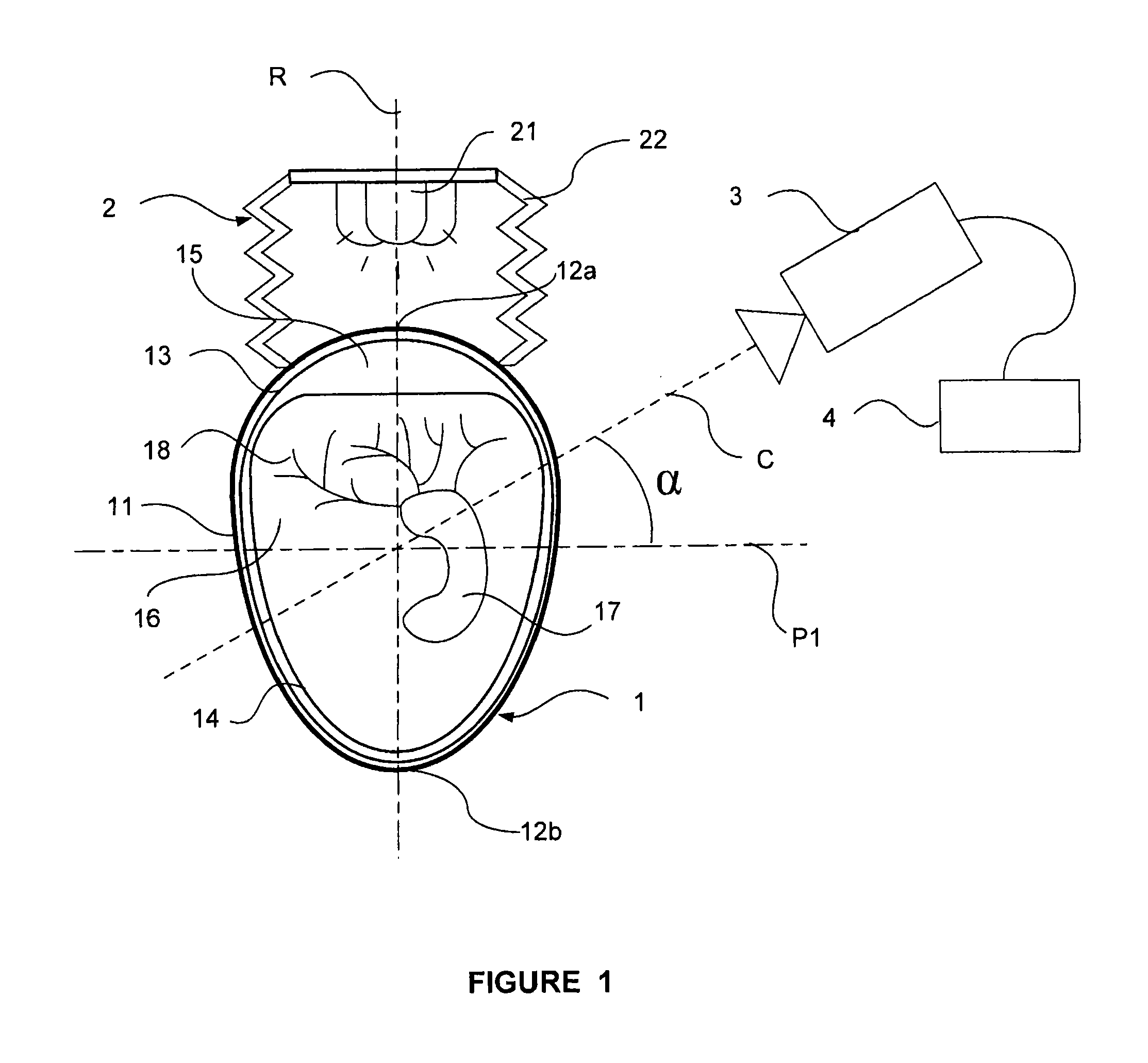 Egg candling method and corresponding device