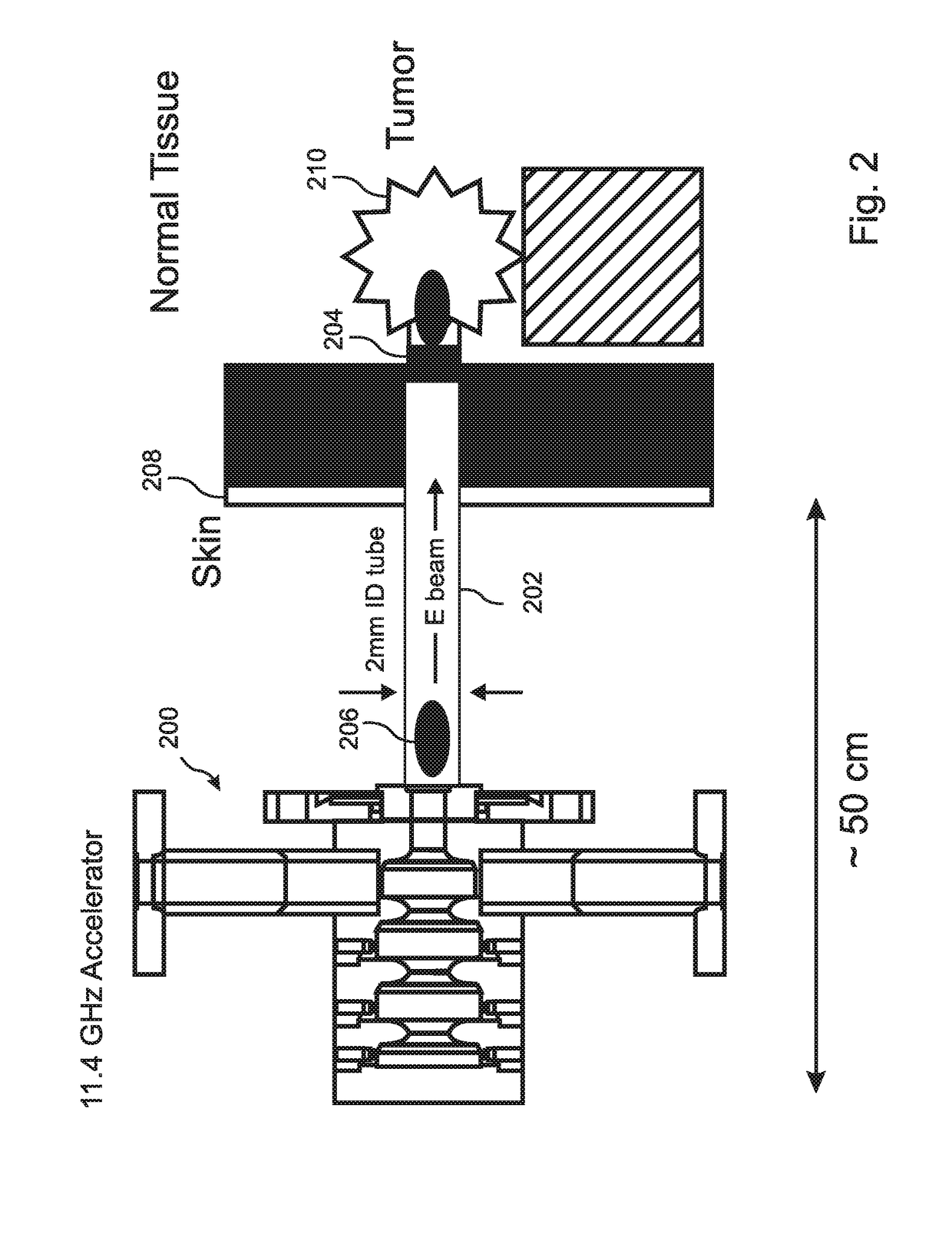 High brightness electron beam based precise radiation therapy methode and system