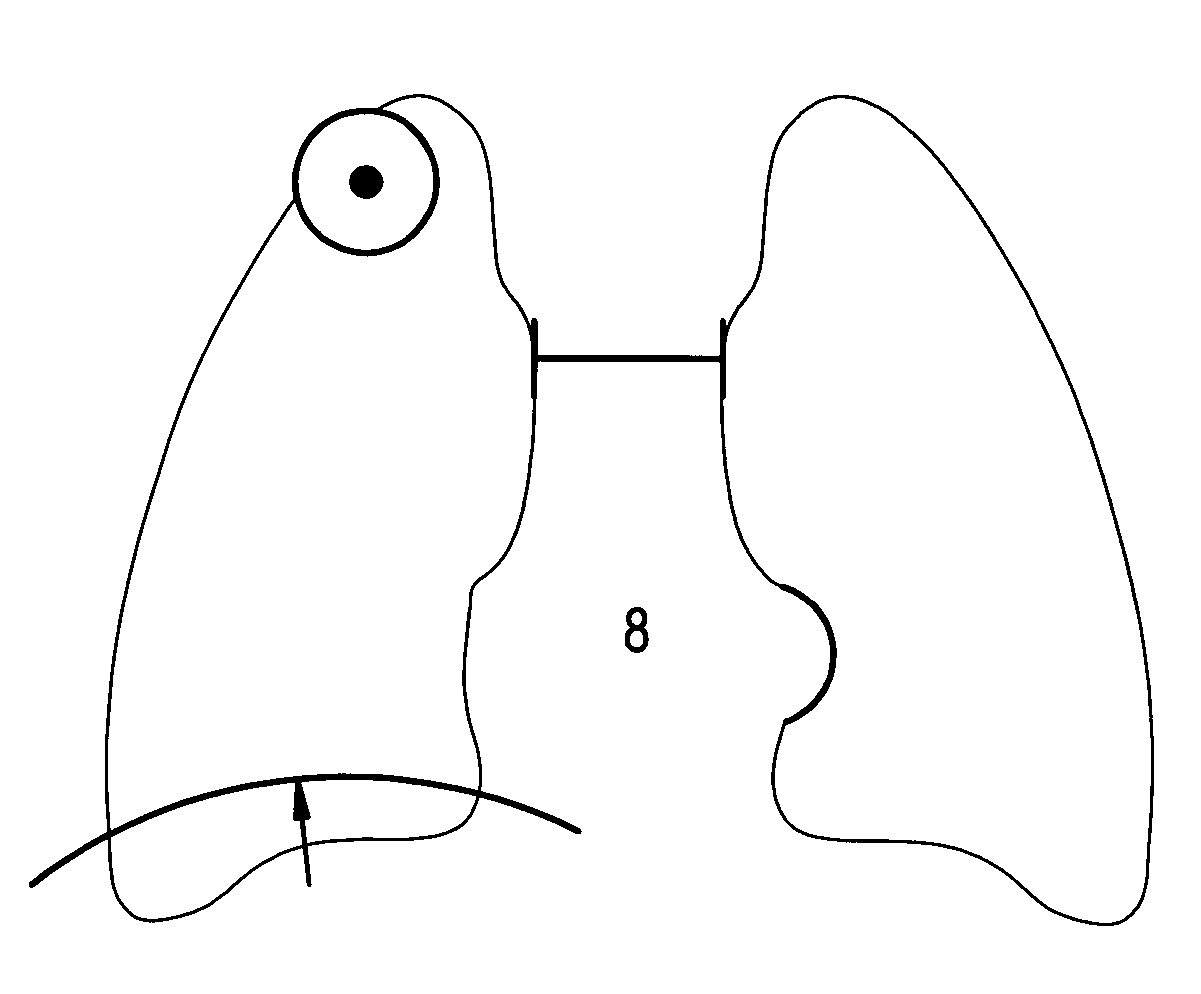 Gesture-based reporting method and system