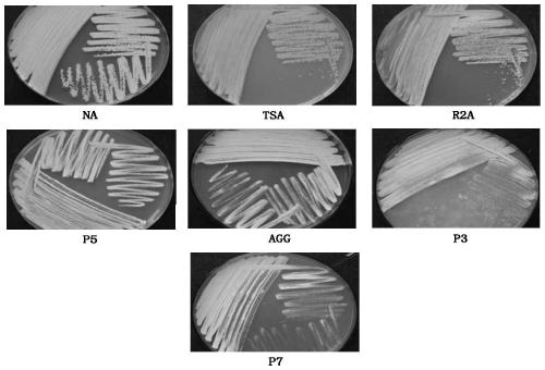 Streptomyces carpaticus and application thereof