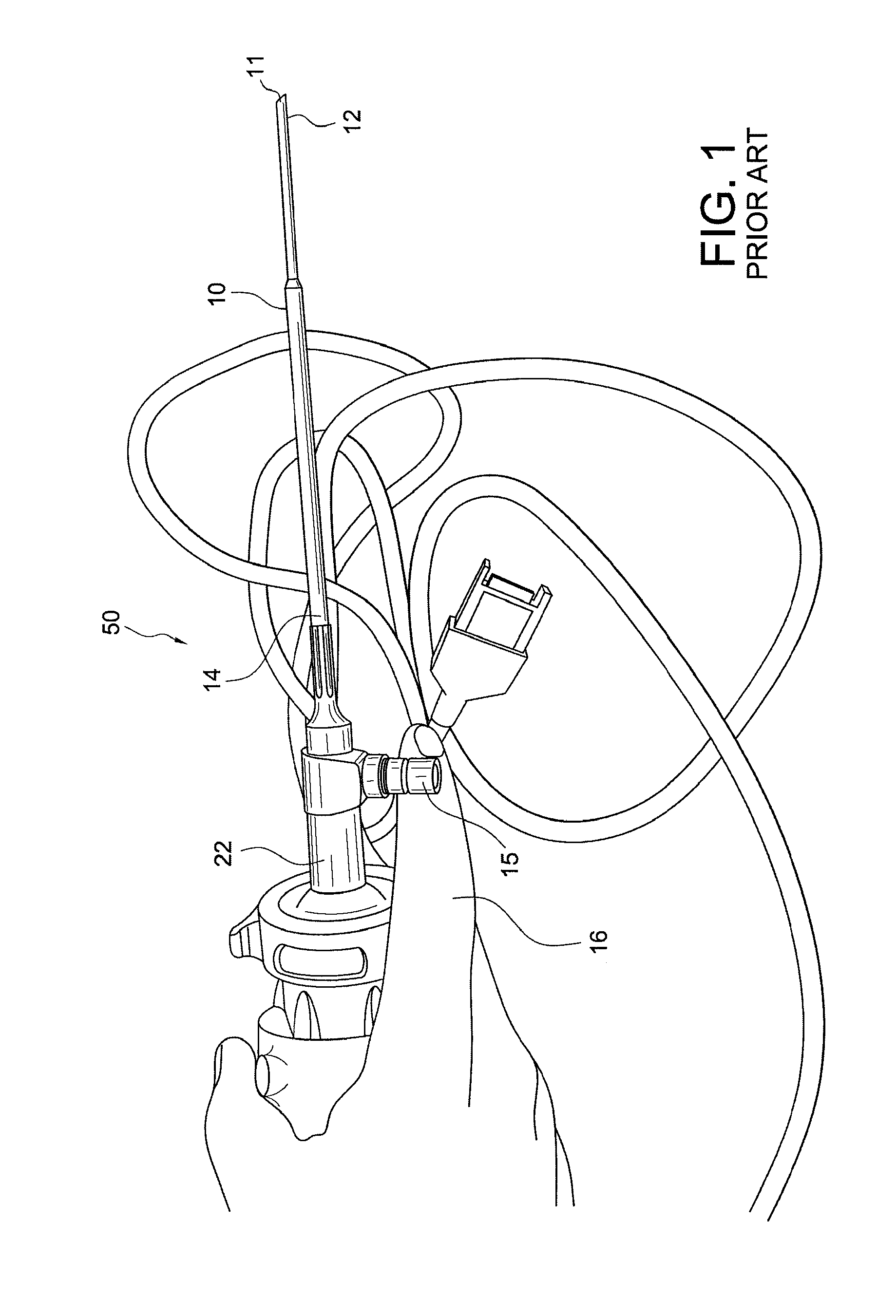 Arthroscope rotation mechanisms and methods of endoscopic rotation