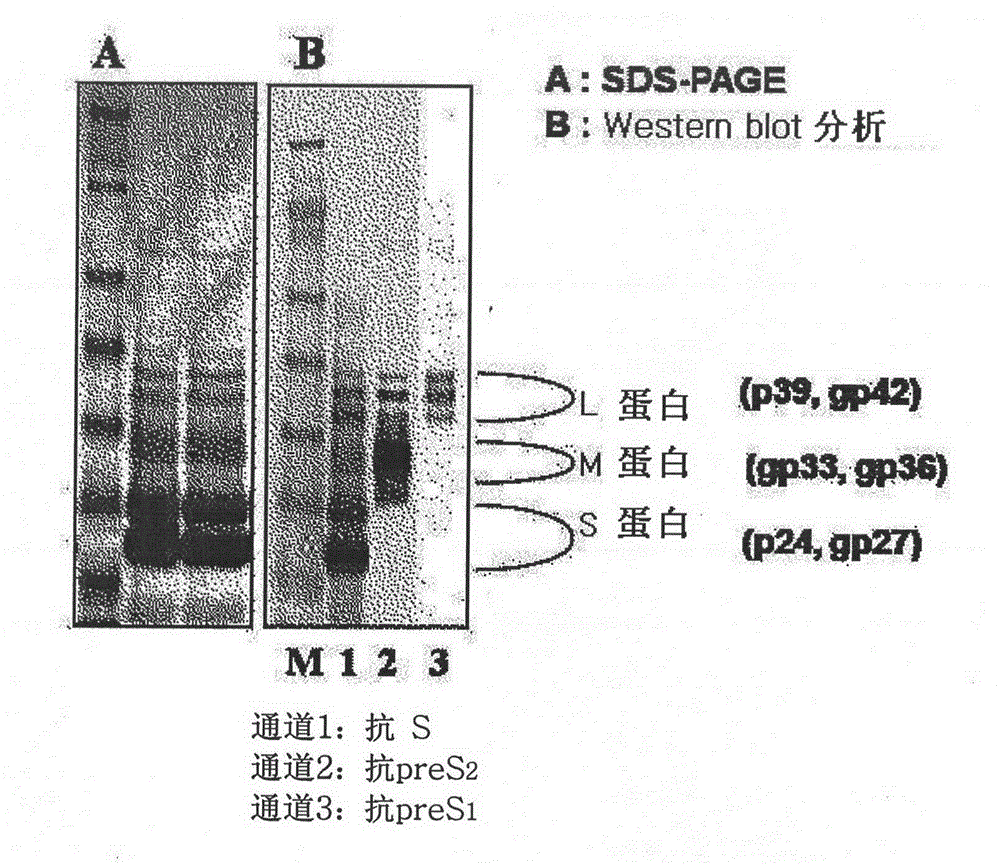 Hepatitis b vaccine and preparation technology thereof