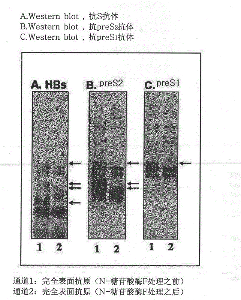 Hepatitis b vaccine and preparation technology thereof