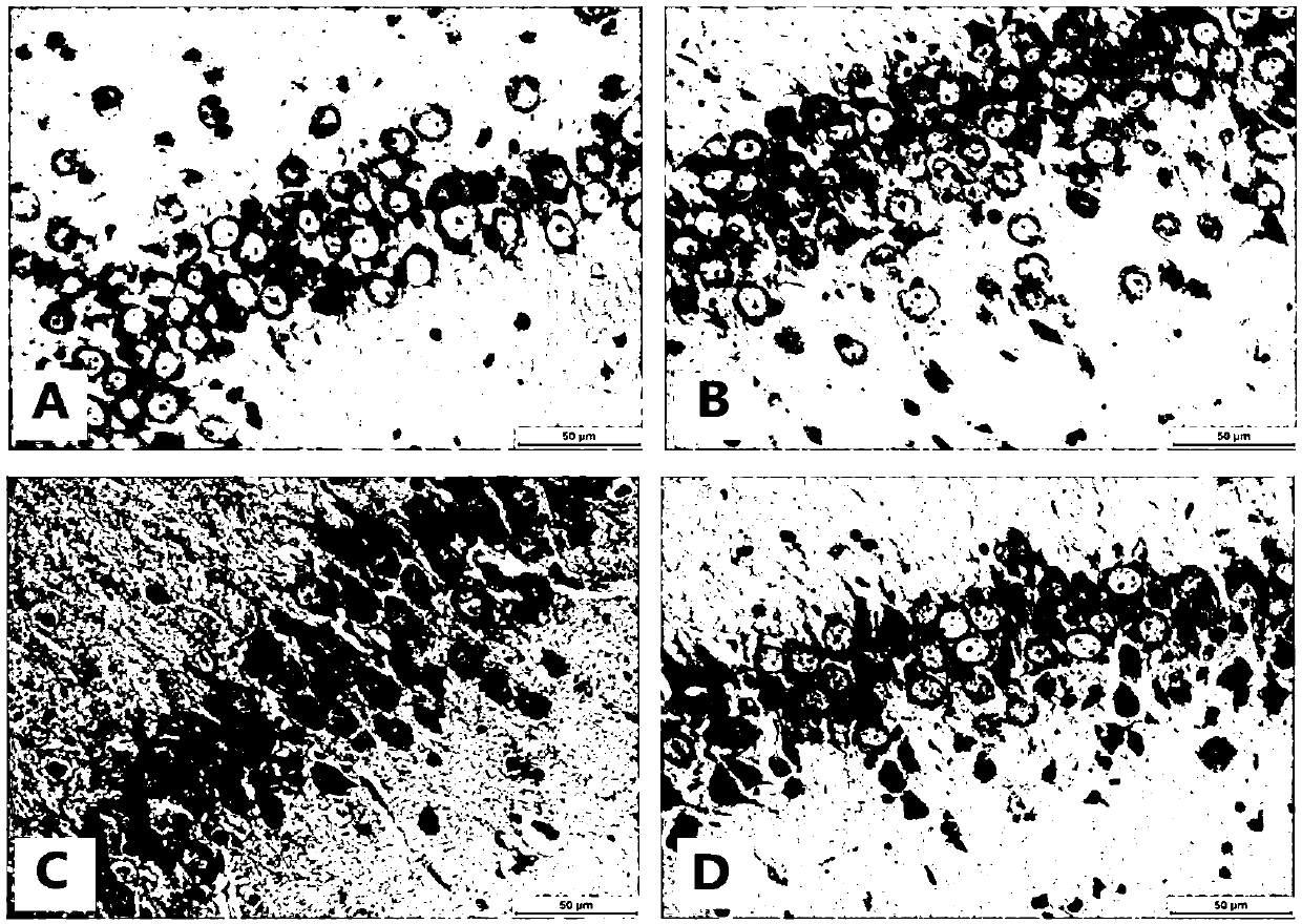 Braf protein of biological marker for detecting brain damage induced by microwave radiation