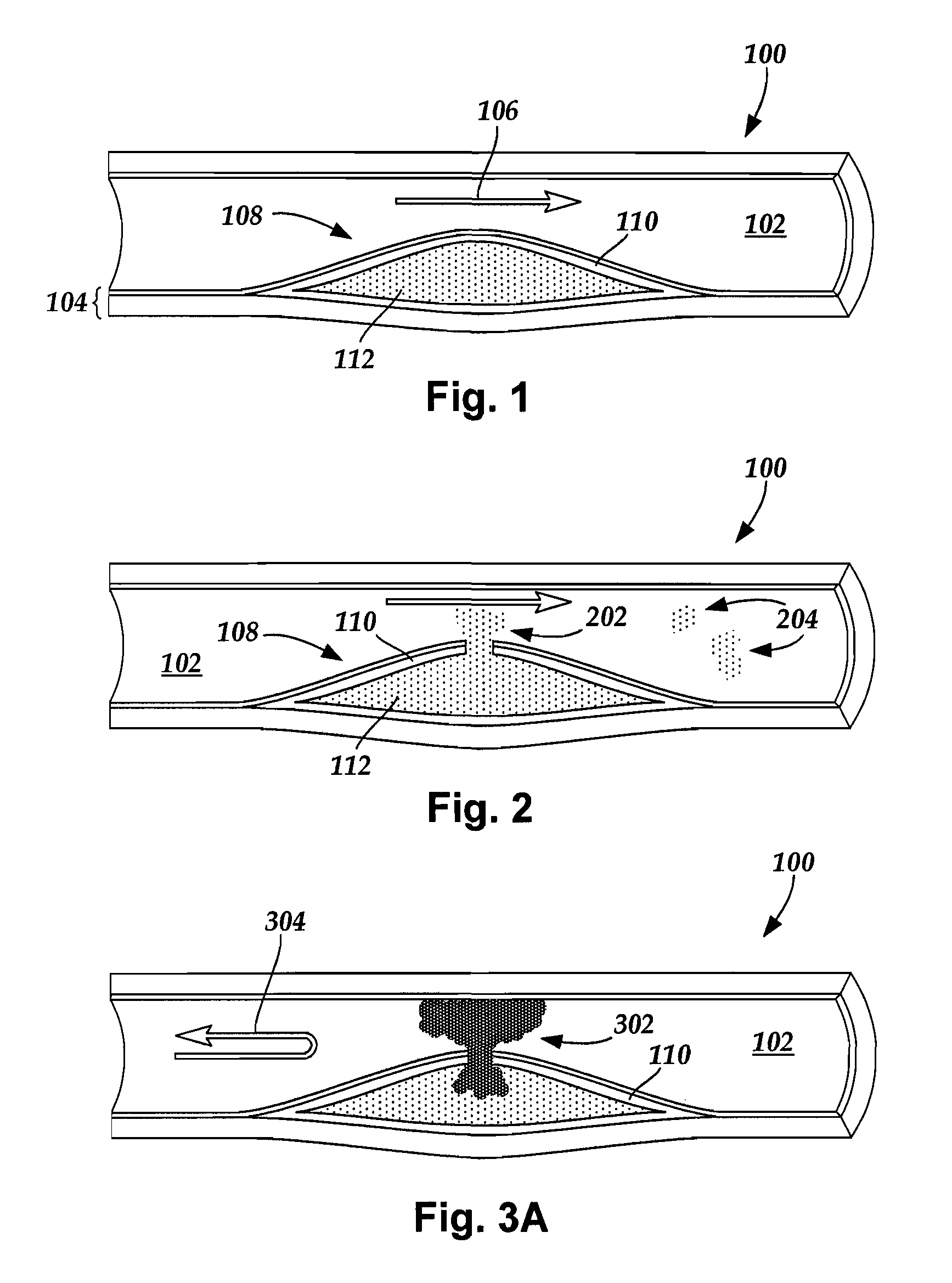 System and method for in vivo imaging of blood vessel walls to detect microcalcifications