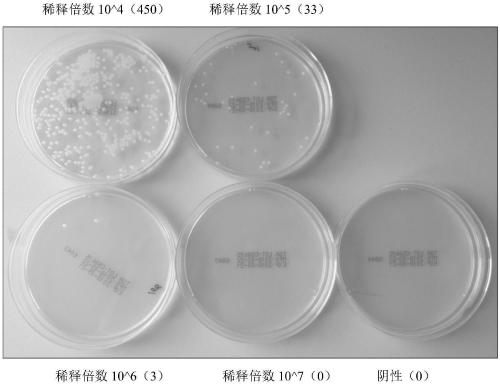 Method for detecting bacteria by amplifying conserved region sequence of 16S rDNA