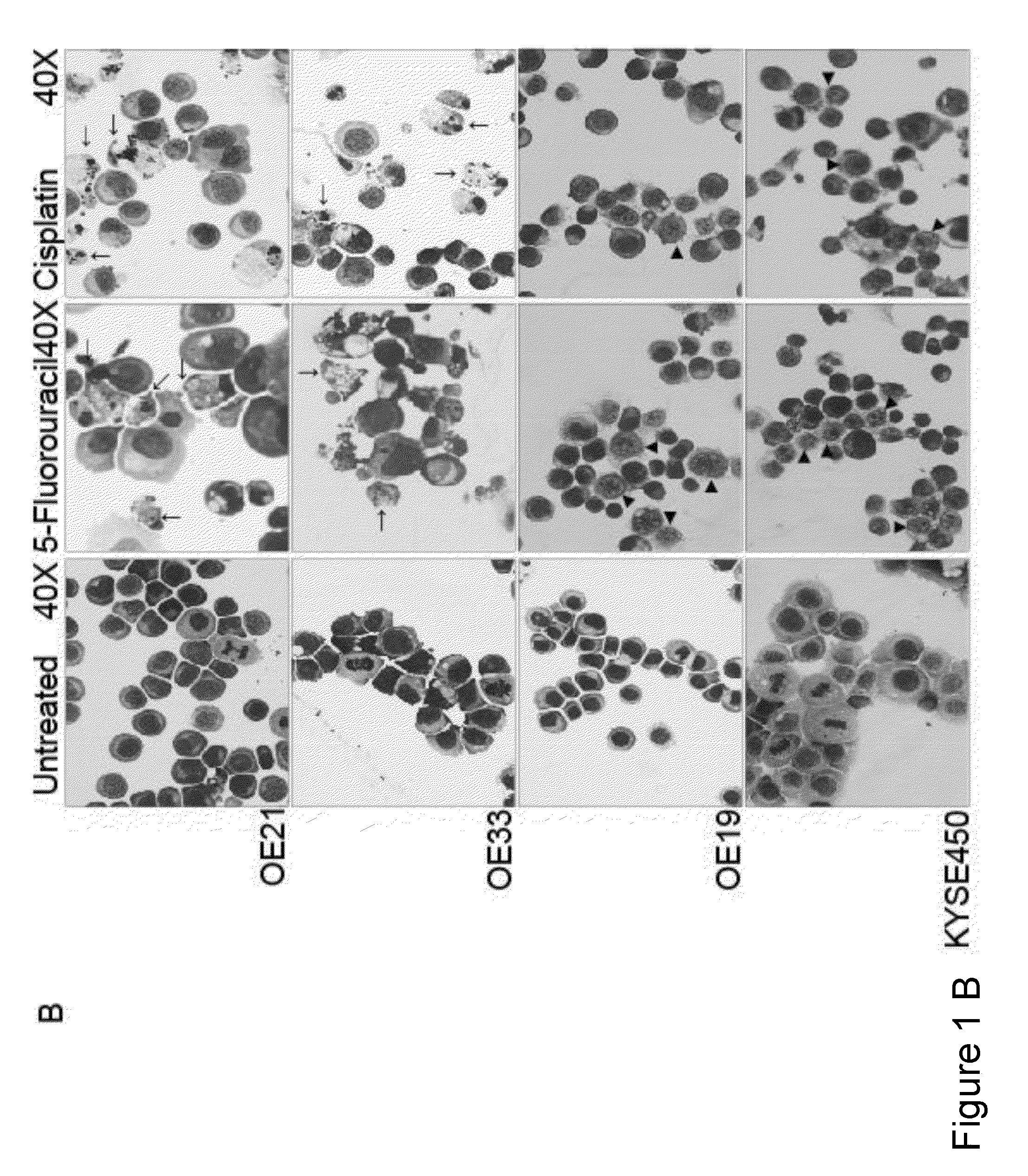 Method for the treatment of cancer