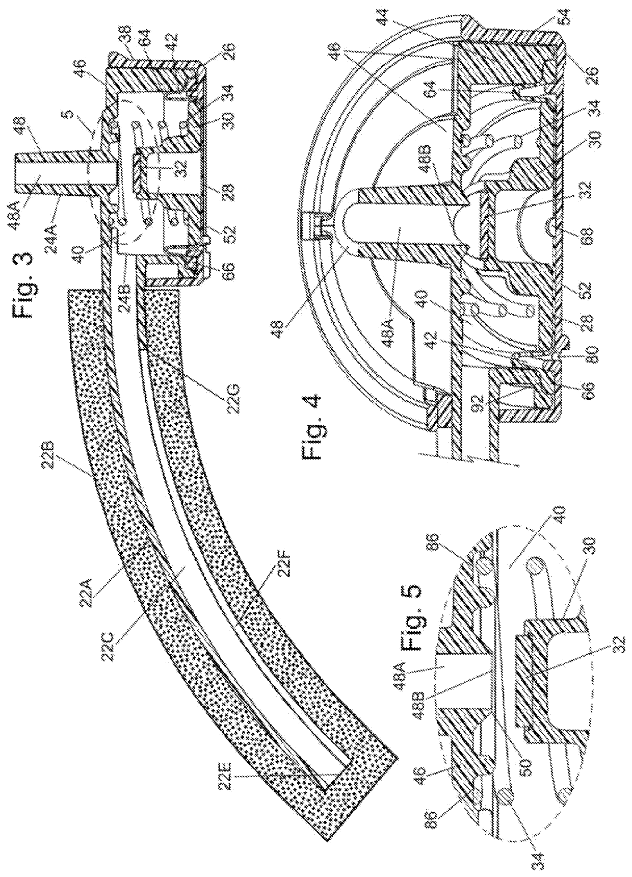 Leakage resistant external female catheter system and method of use