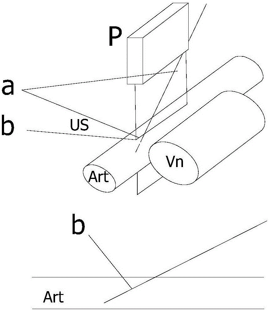 Vein puncture device and system and vein puncture control method