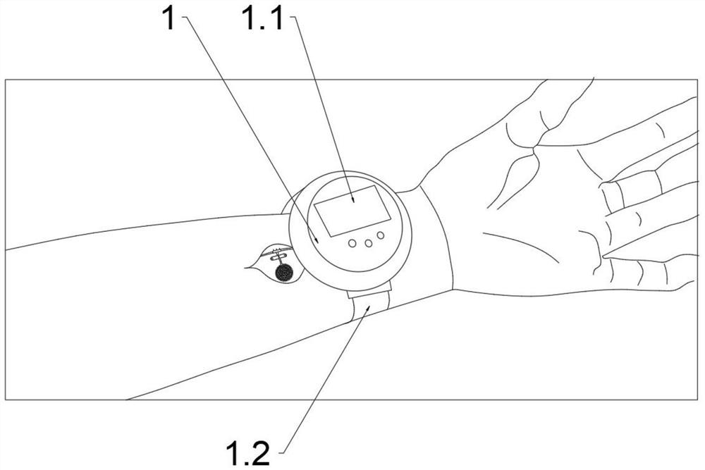 Device for inducing nerve rehabilitation and regeneration through radio stimulation