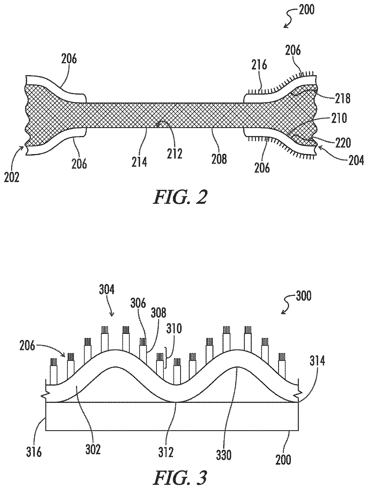 Biliary Stent