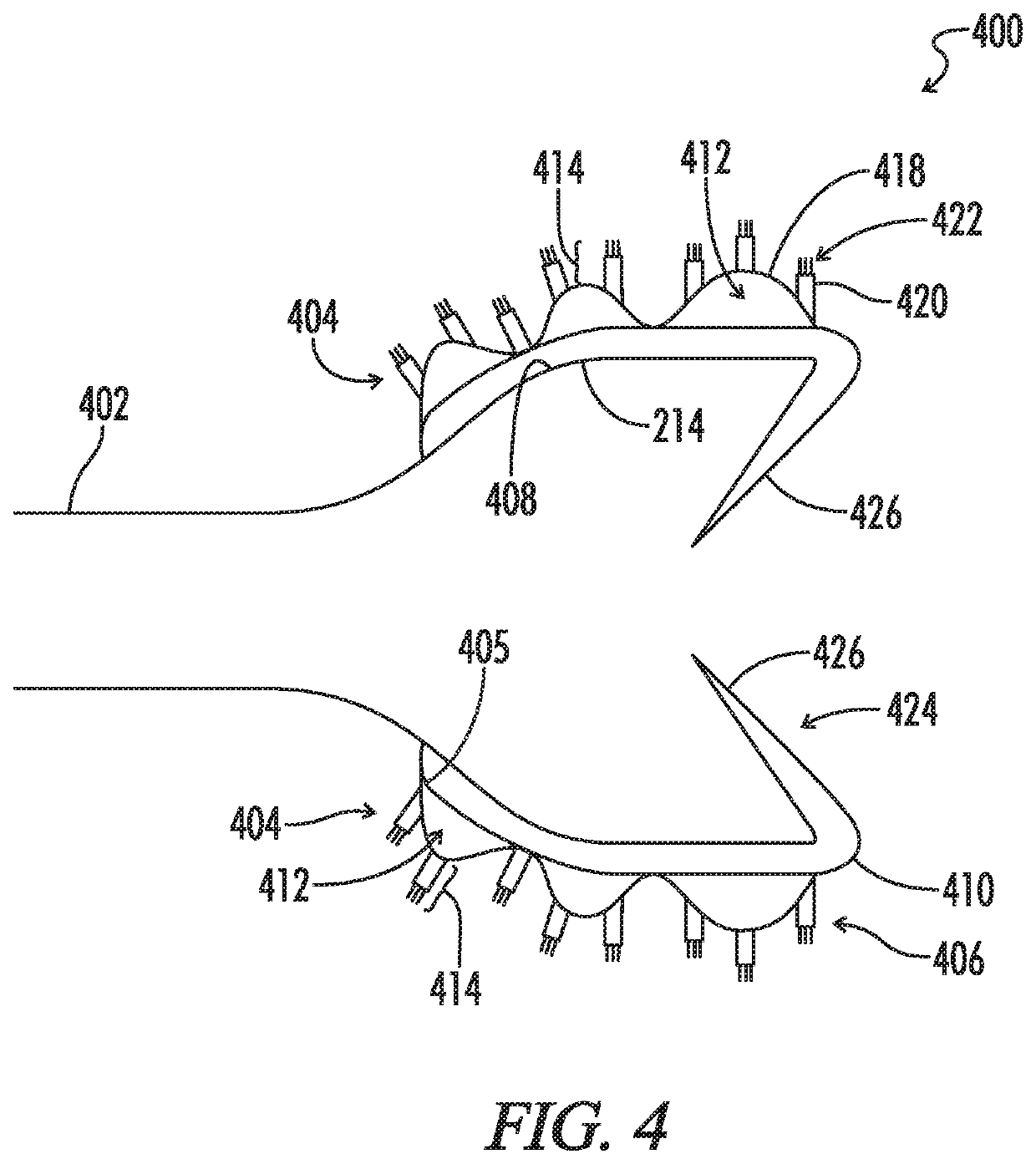 Biliary Stent