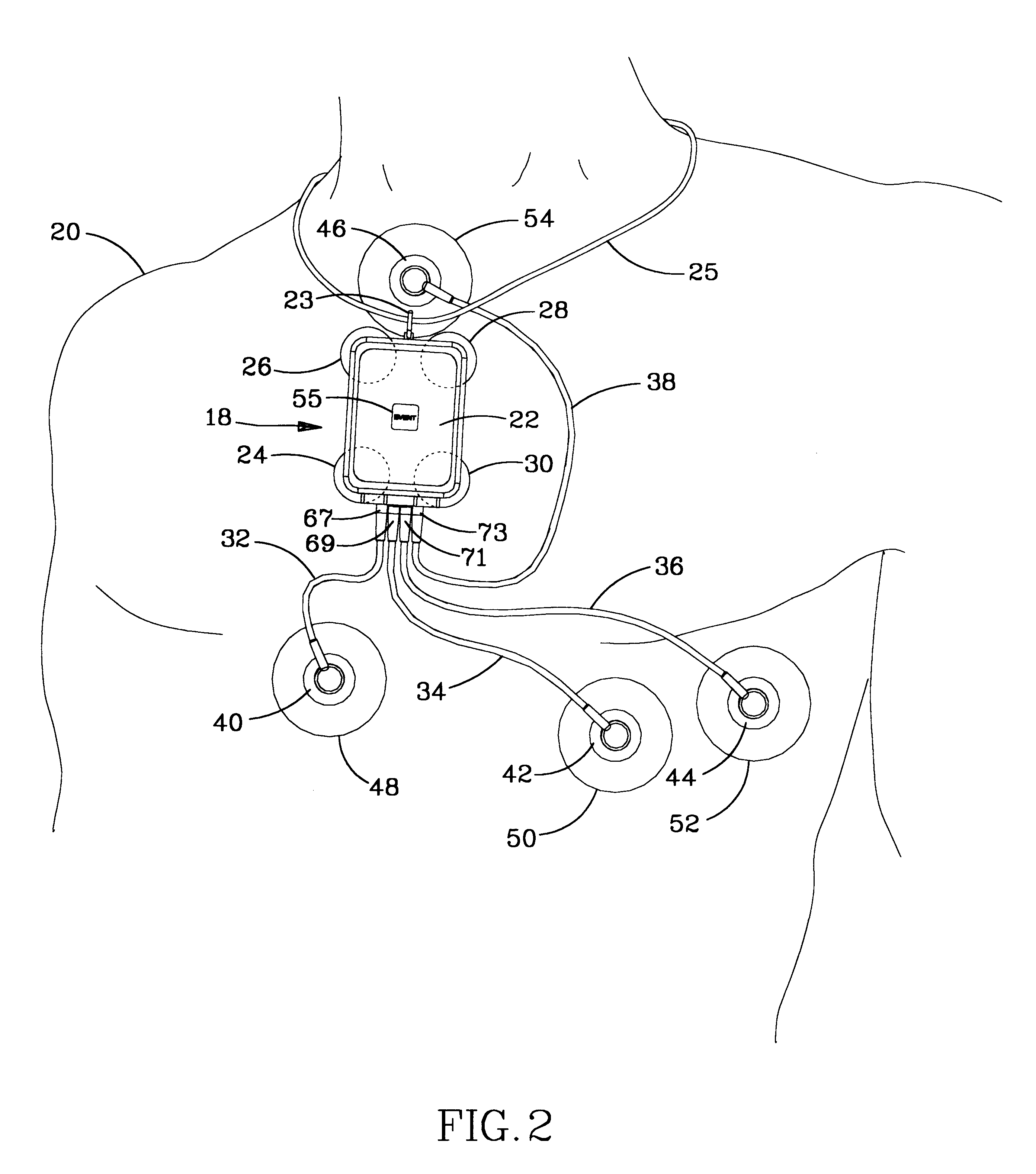 Ambulatory physio-kinetic monitor with envelope enclosure