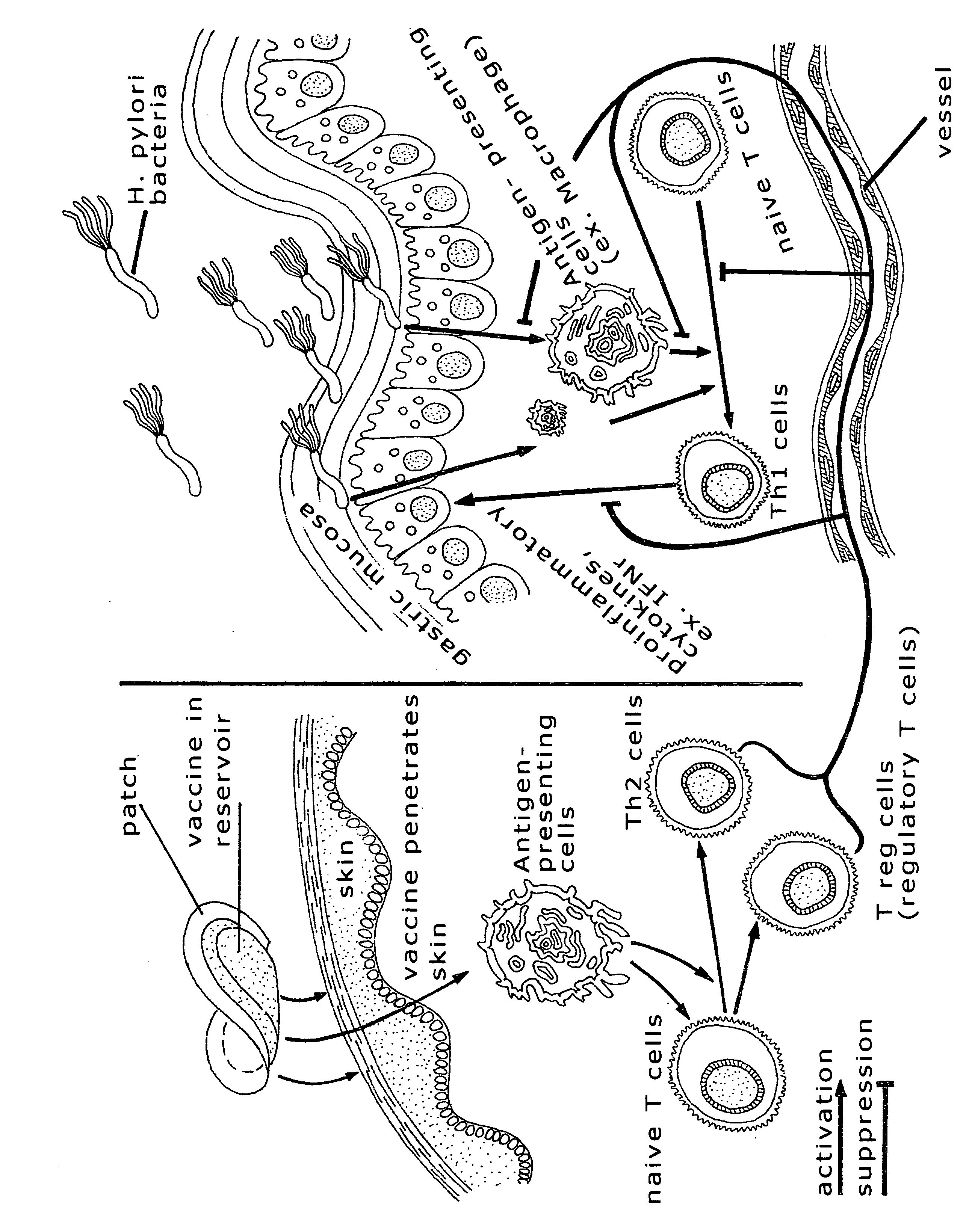 Immune compositions for treating H. pylori infection