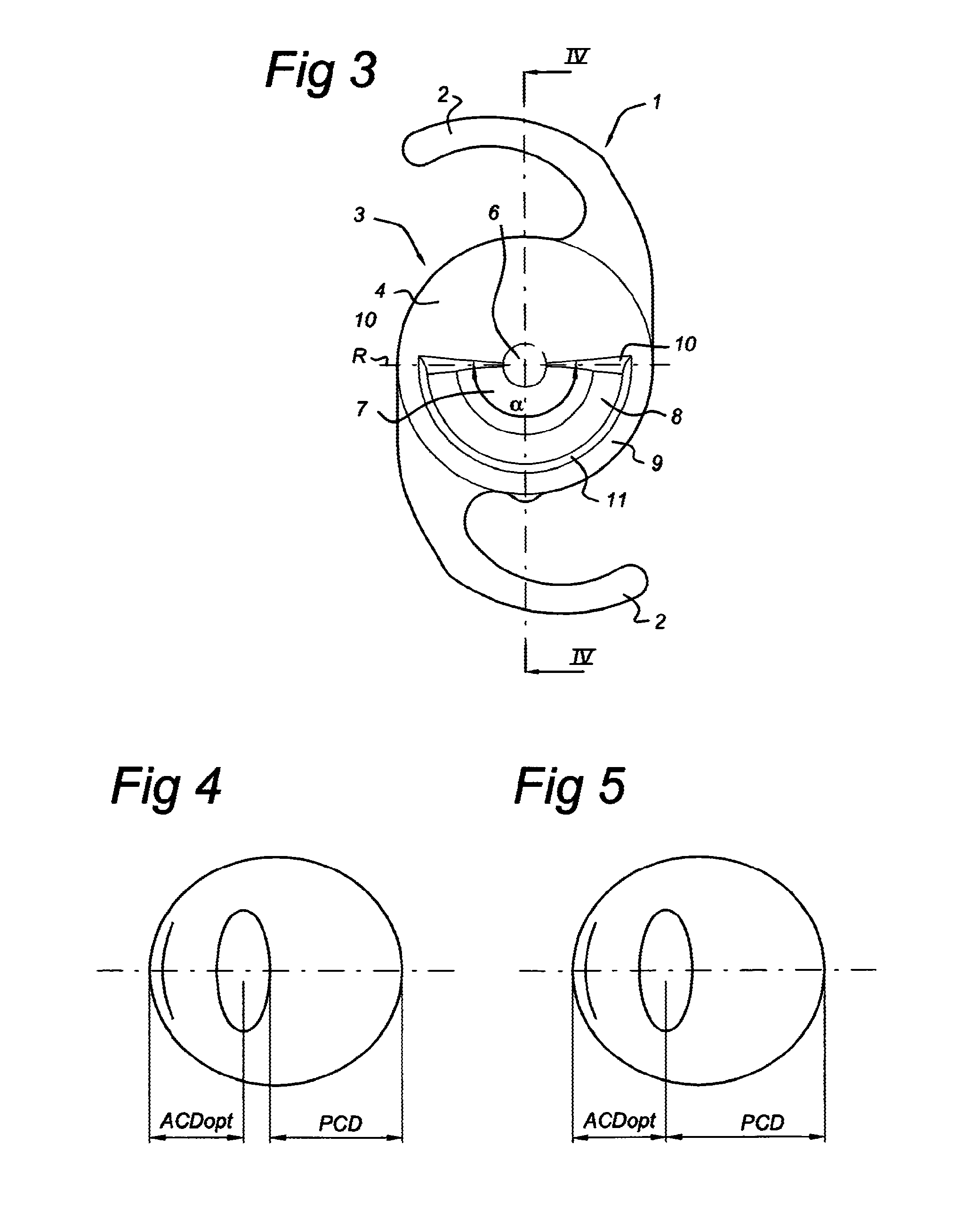 Intra ocular lens