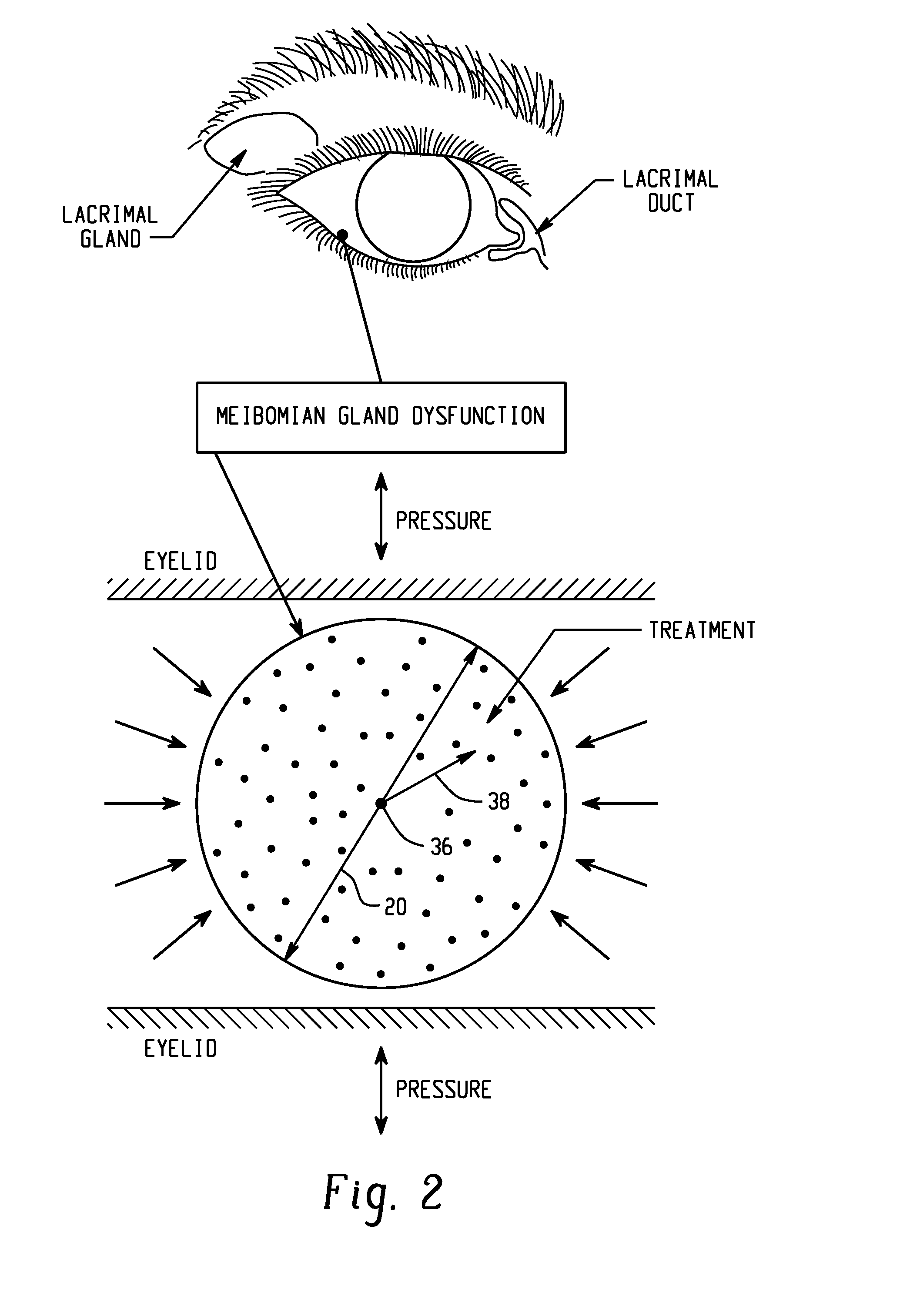 Methods for treating eye conditions