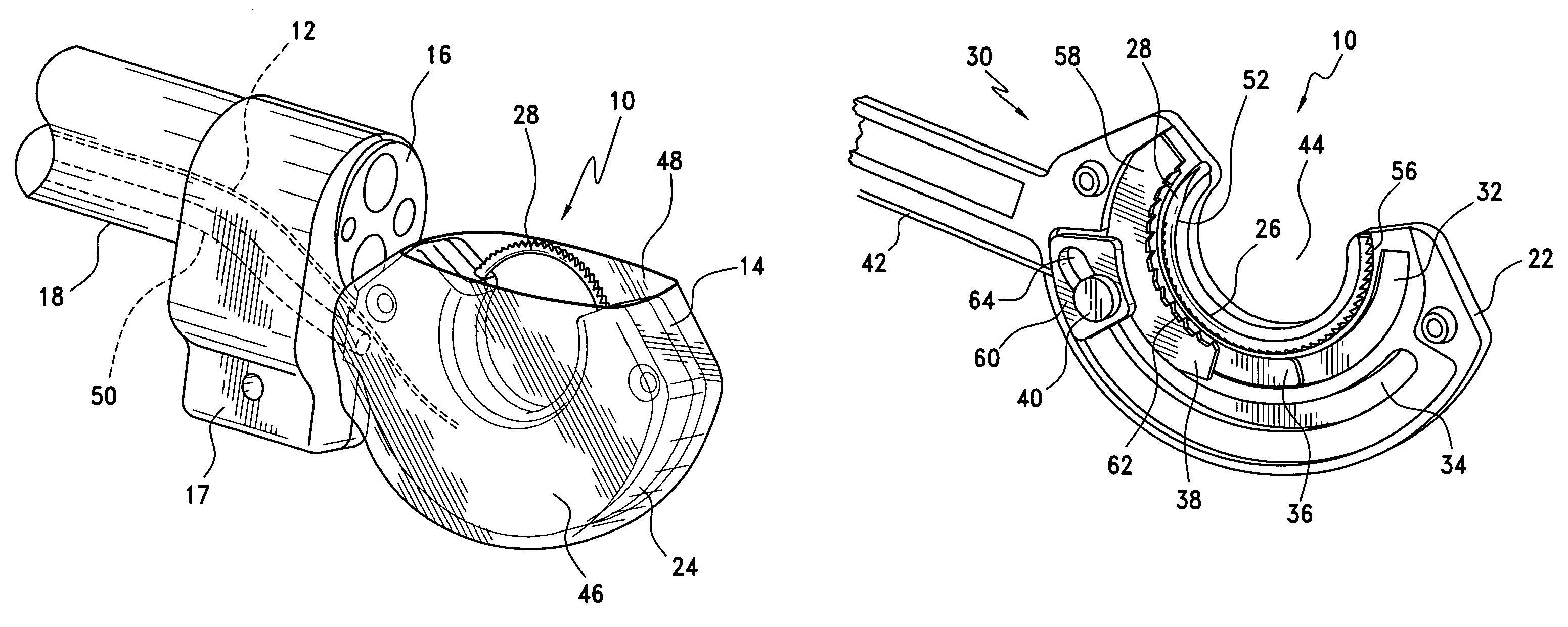 Surgical suturing apparatus