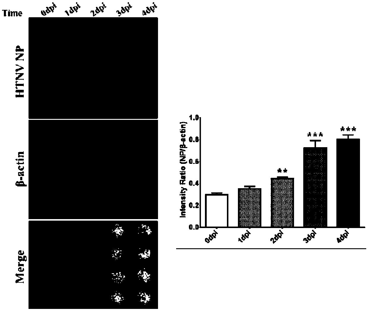 A high-throughput method for rapid detection of Hantaan virus neutralizing antibody titer