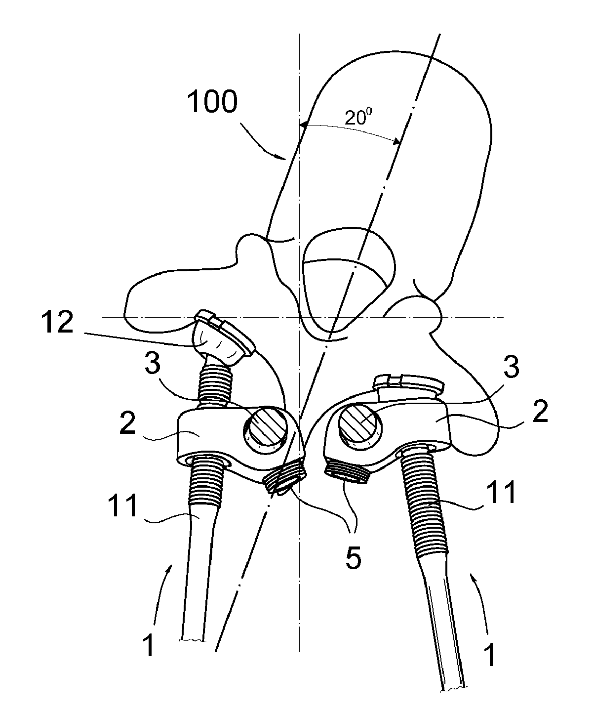 Method for rotating a vertebra or vertebrae