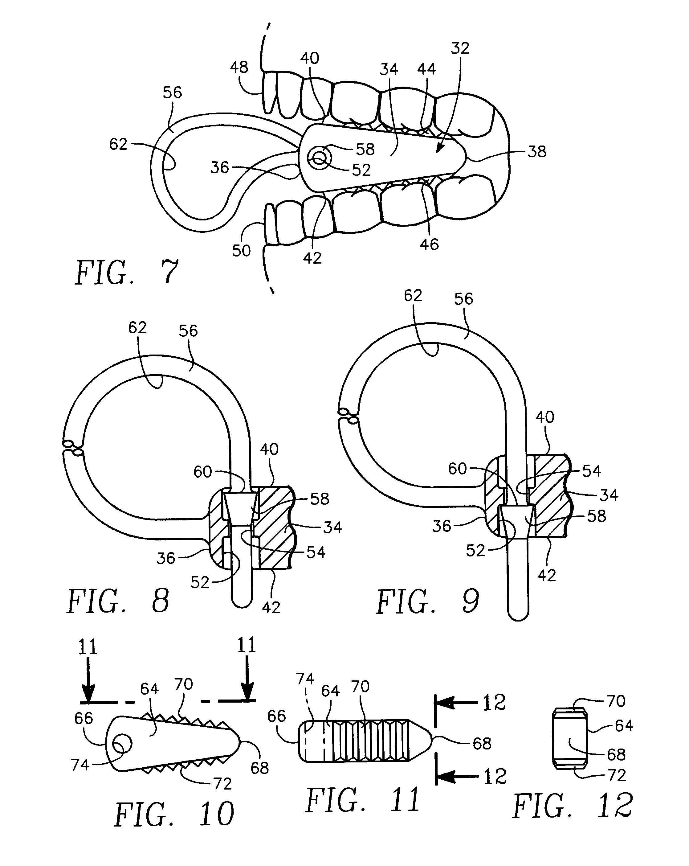 Mouth block