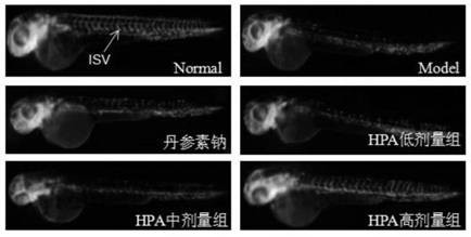 Application of p-hydroxyphenylacetic acid in prevention and/or treatment of cardiovascular diseases