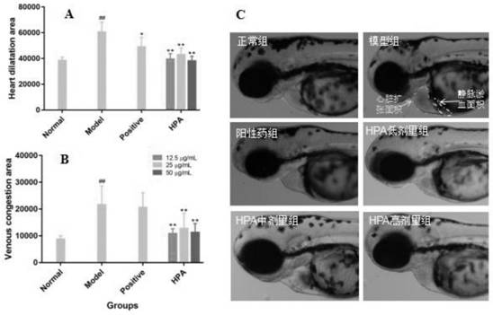 Application of p-hydroxyphenylacetic acid in prevention and/or treatment of cardiovascular diseases