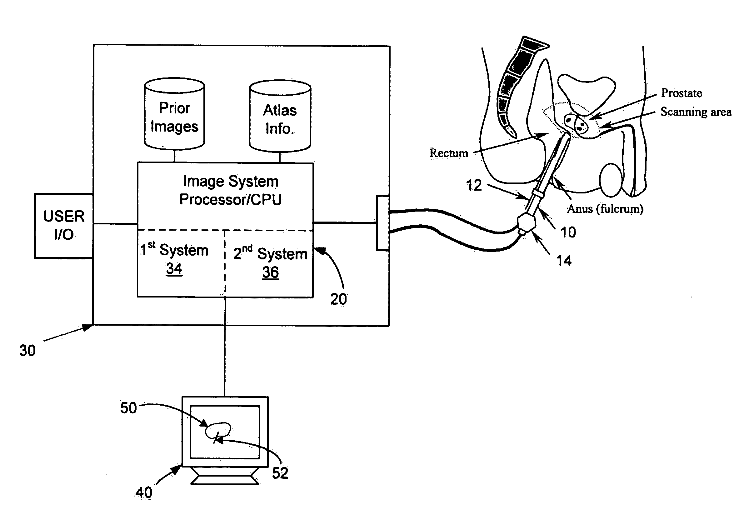 Method for tissue culture extraction