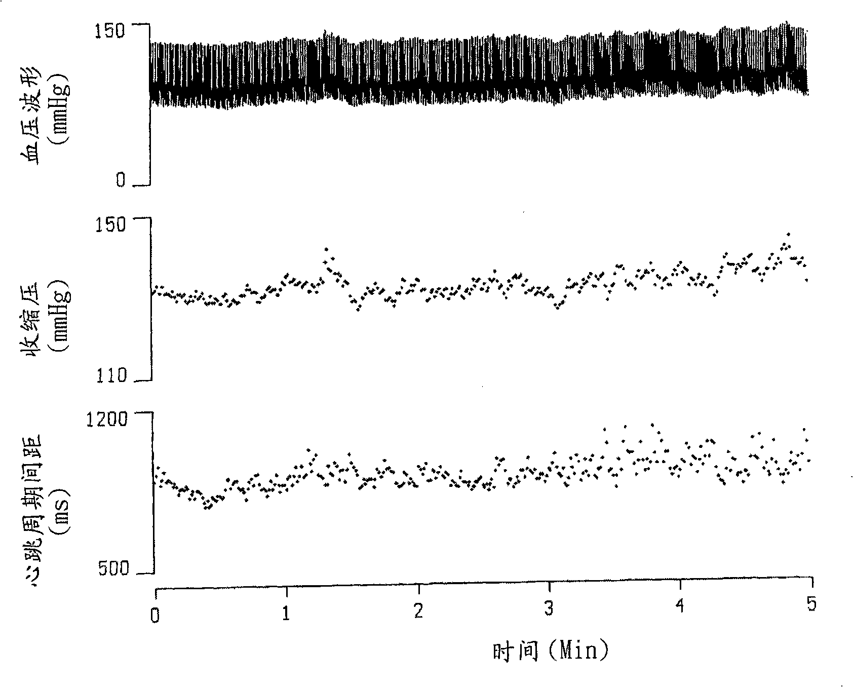 Analytic system and method of traditional Chinese medicine pulse diagnosis