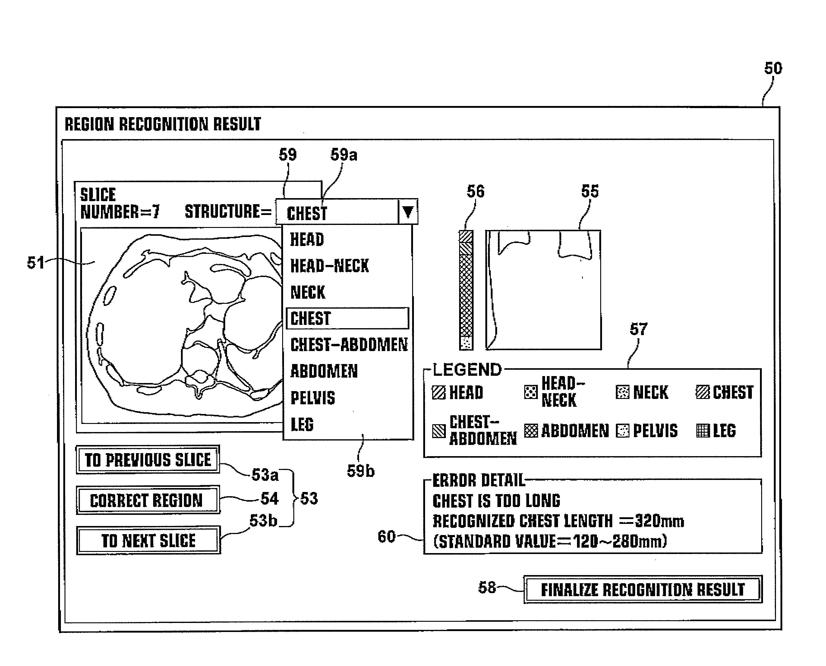 Method, apparatus, and program for judging image recognition results, and computer readable medium having the program stored therein