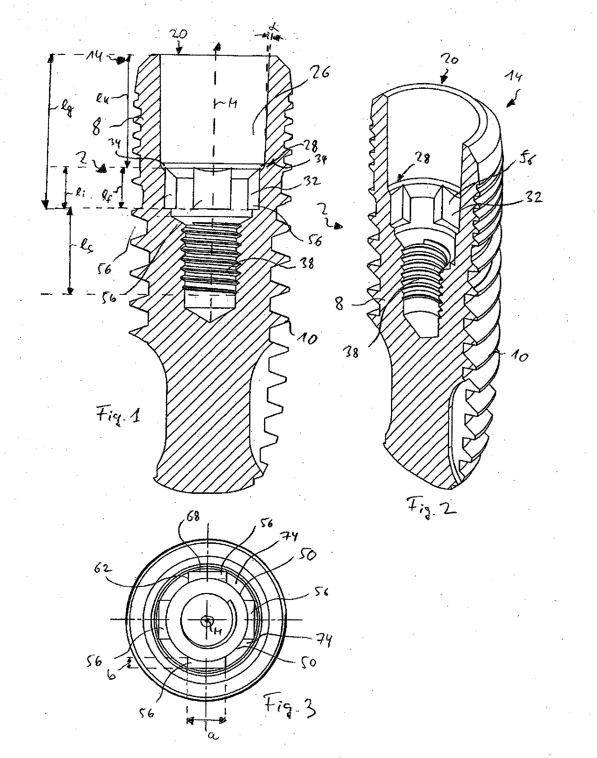 Dental implant, abutment, implant system and implant set