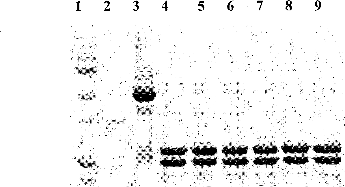 Antihuman SCGN monoclone antibody, preparation, application and hybrid tumor cell strain