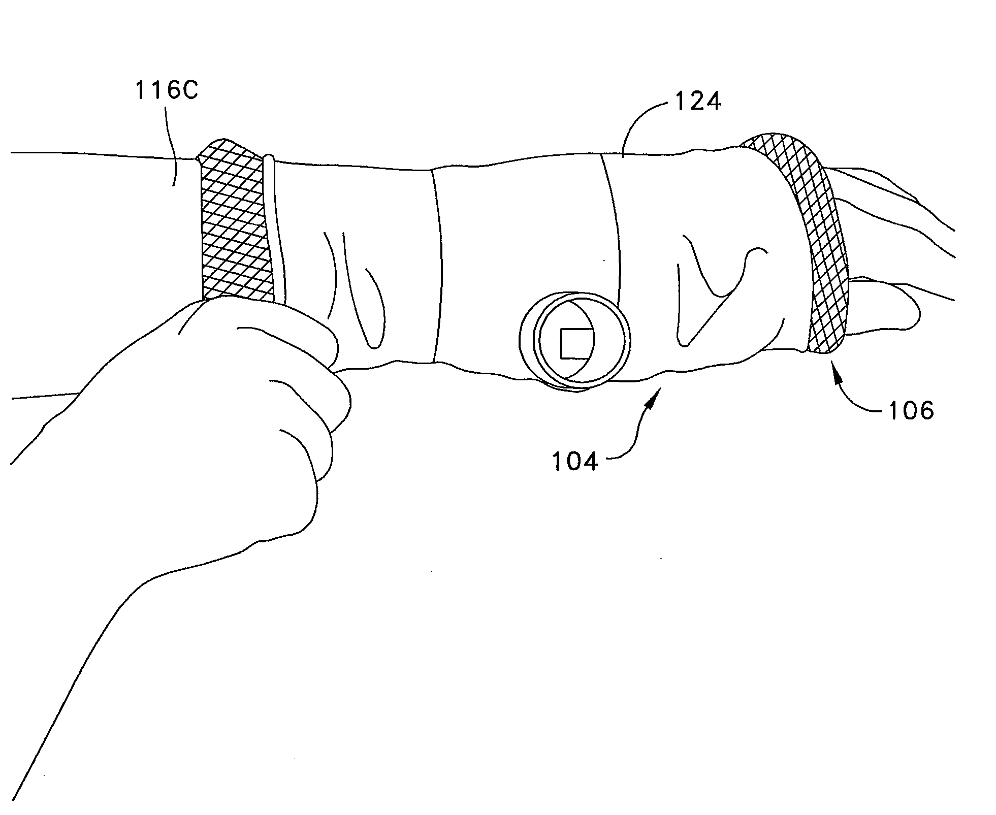 Apparatus and method of creating airflow through a breathable orthopedic cast