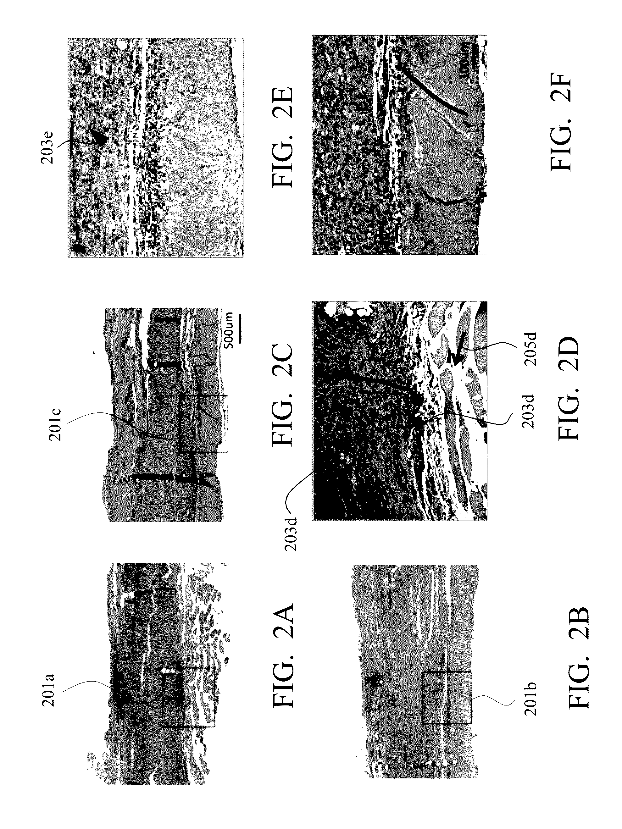 Tissue regeneration membrane for repair and regeneration of peripheral nerve