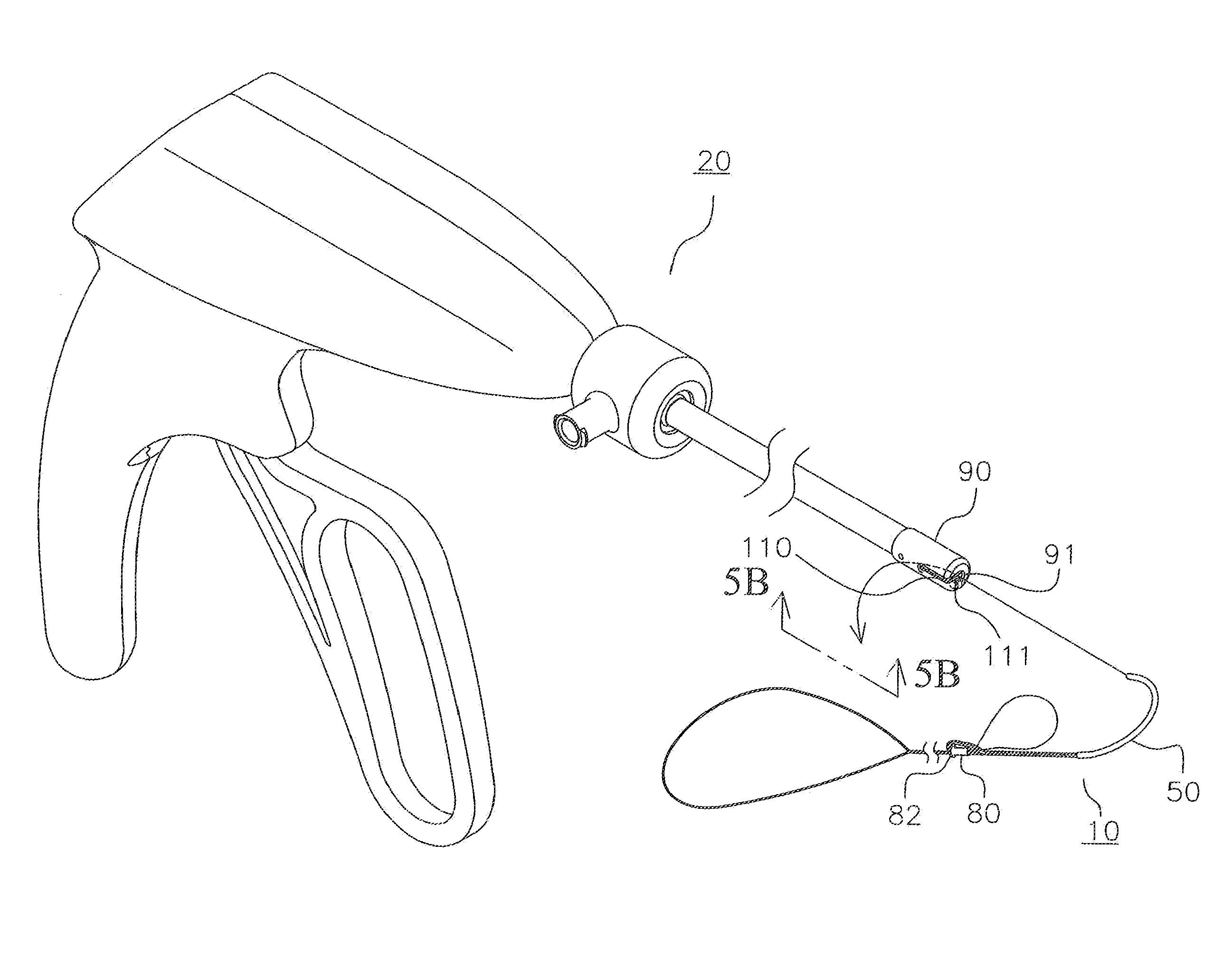 Method and devices for securing bidirectional suture loops using coaxial mechanical fasteners