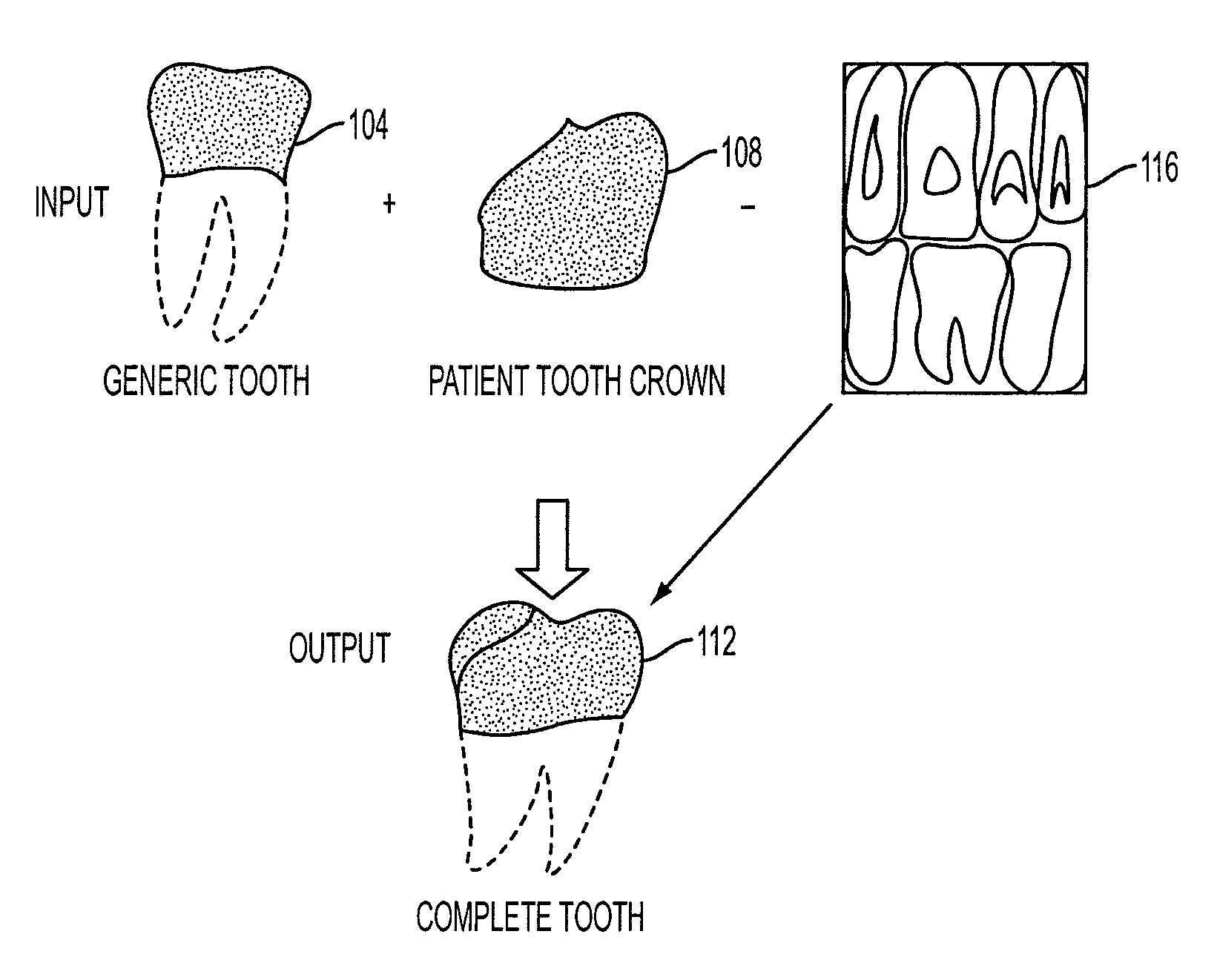 System and method for improved dental geometry representation