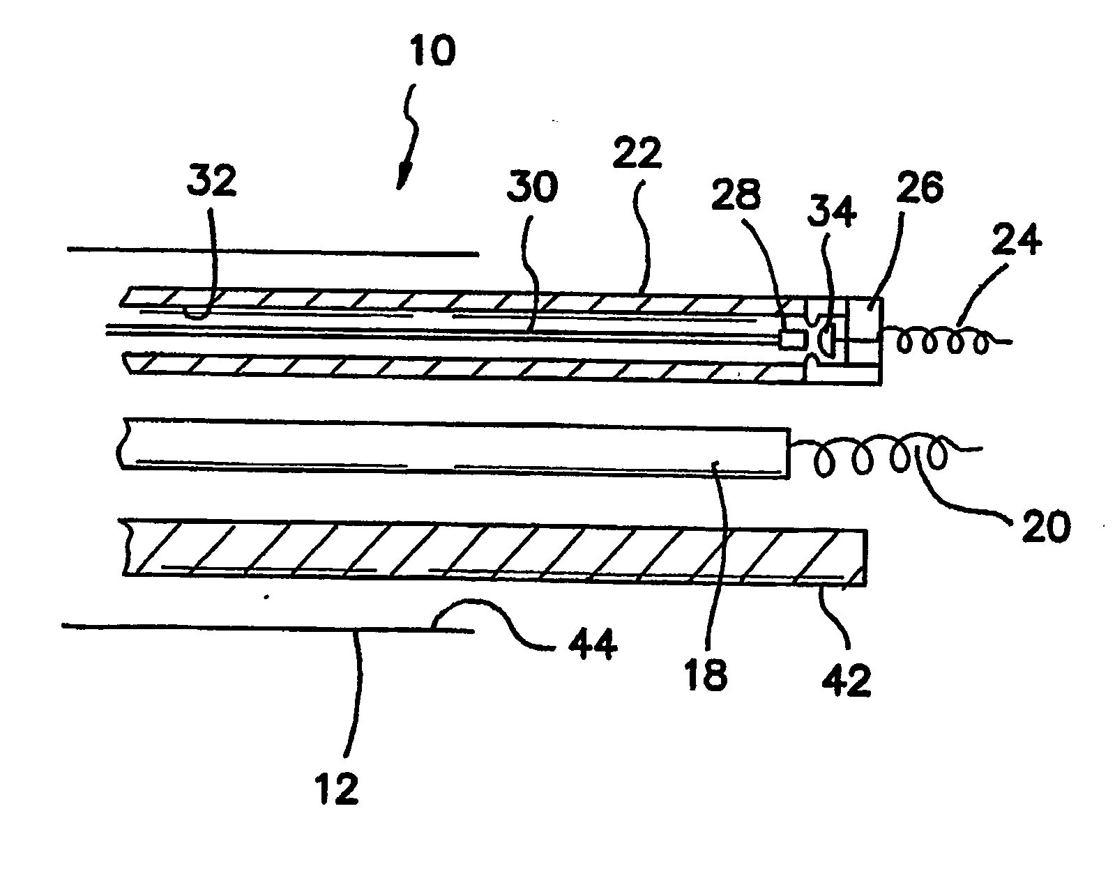 Method and apparatus for anchoring of pacing leads