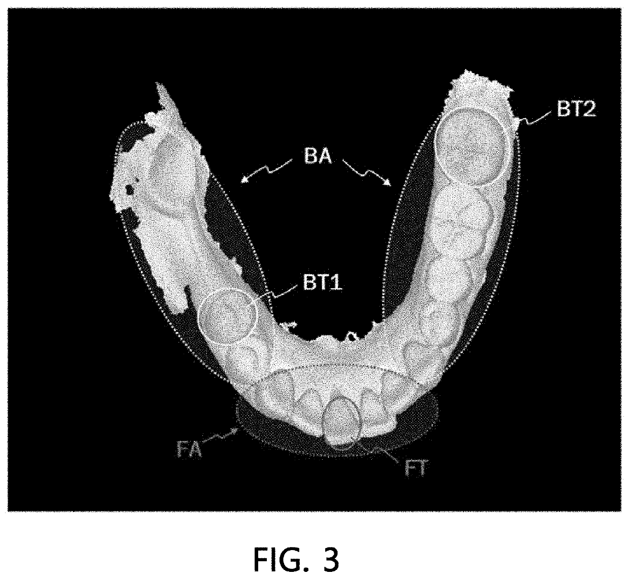 Dental object detection method, and image matching method and device using dental object