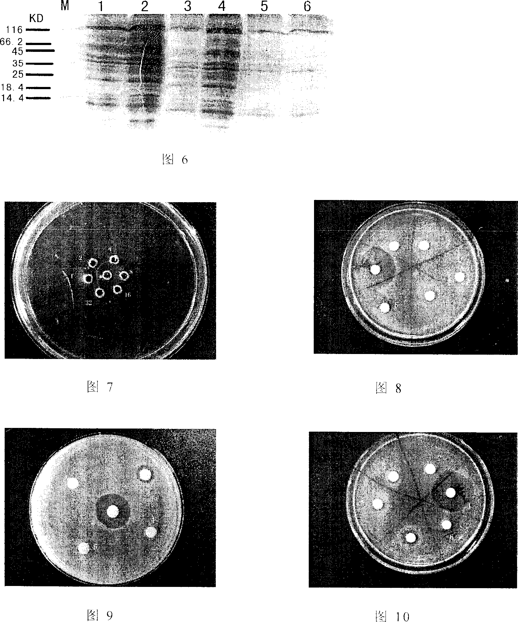 Yeast engineered bacteria for expressing recombinant prawn protein Pen9 and its preparation method and uses