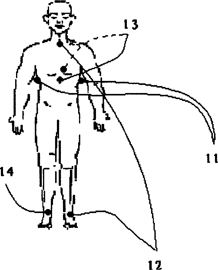 Realtime four-dimensional electro cardiogram imaging method and device