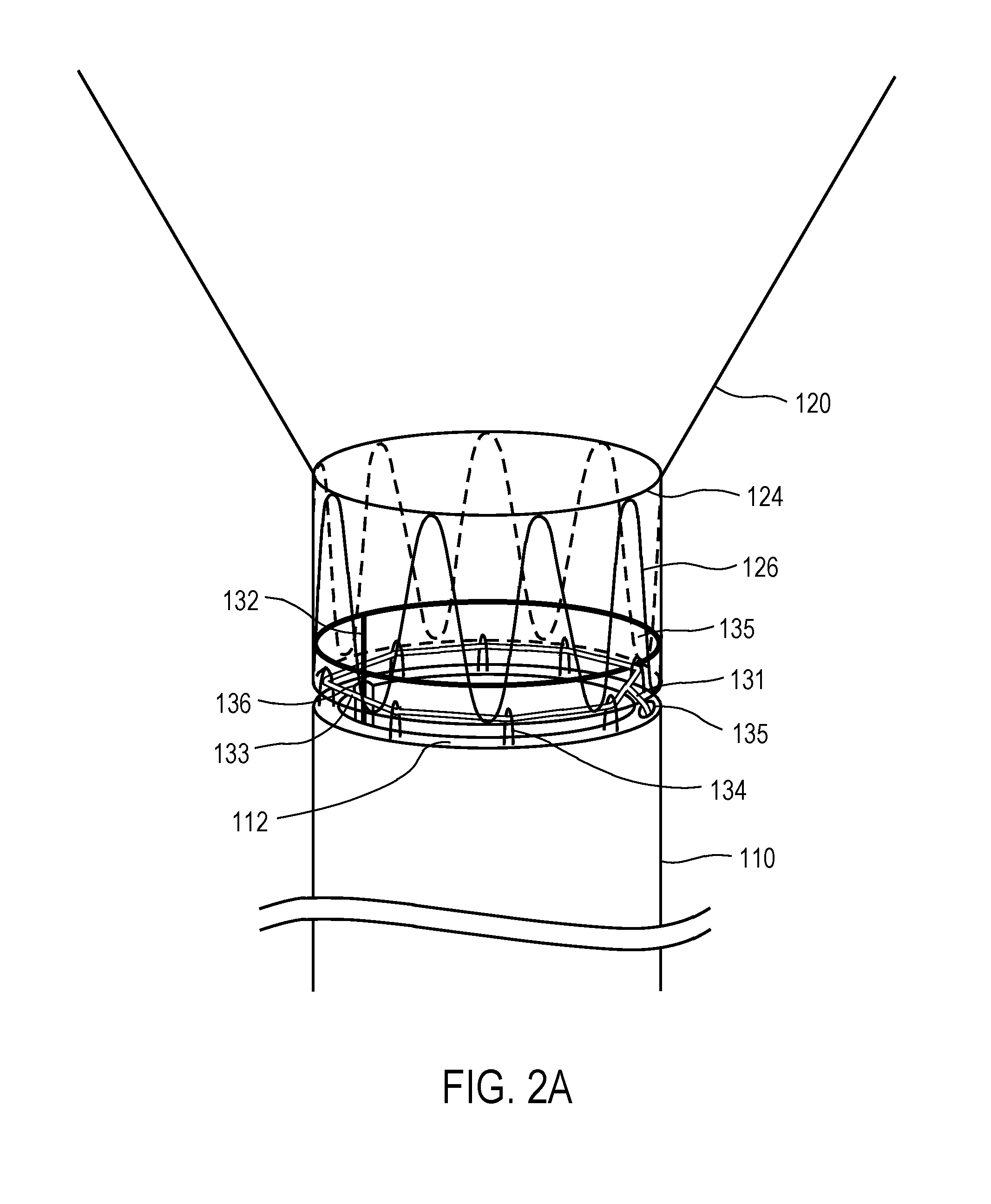 Apparatus and methods for filtering emboli during precutaneous aortic valve replacement and repair procedures with filtration system coupled to distal end of sheath