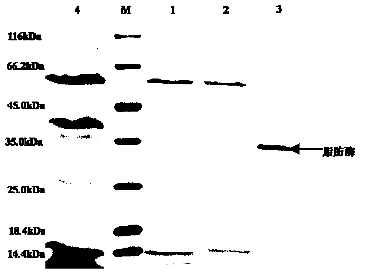 Immobilized lipase and preparation method and application thereof