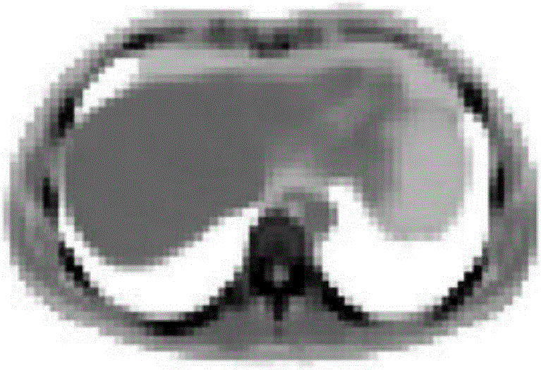 A generation method and system for attenuation images