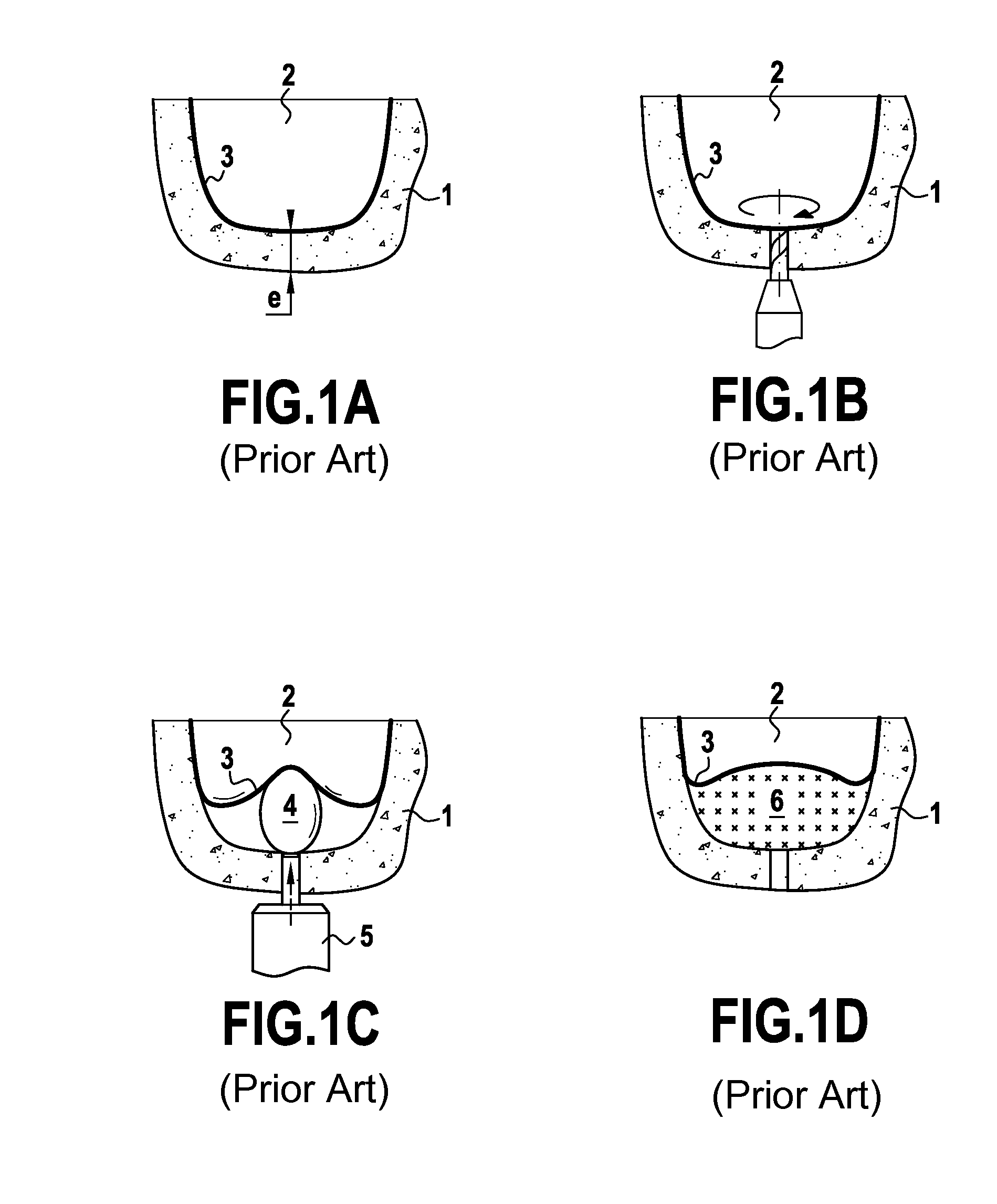 Ultrasonic tip for sinus membrane elevation