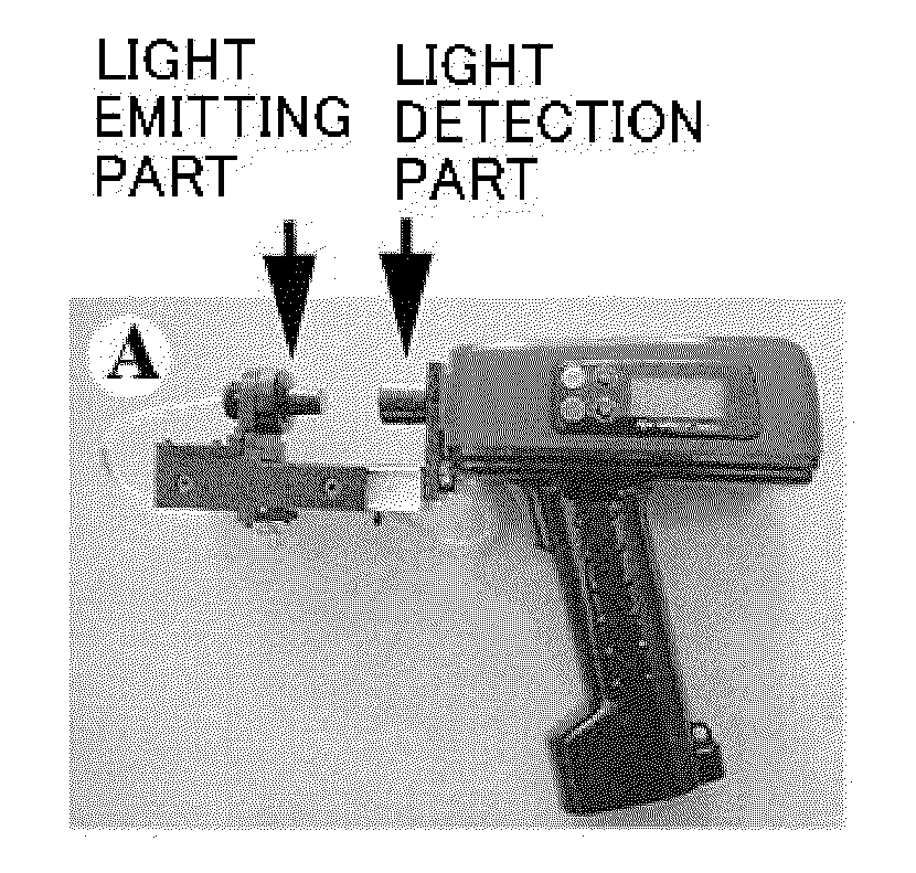 Method and apparatus for examination of cancer, systemic lupus erythematosus (SLE), or antiphospholipid antibody syndrome using near-infrared light