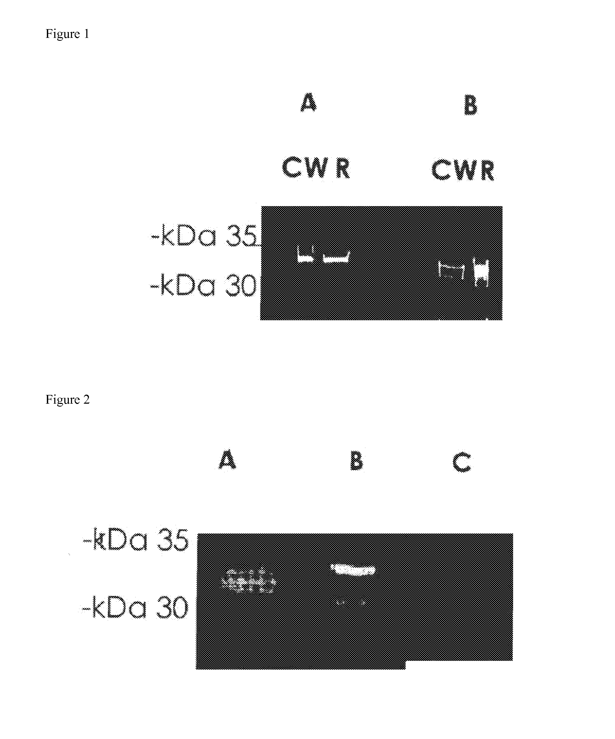 Protein-based <i>Streptococcus pneumoniae </i>vaccine