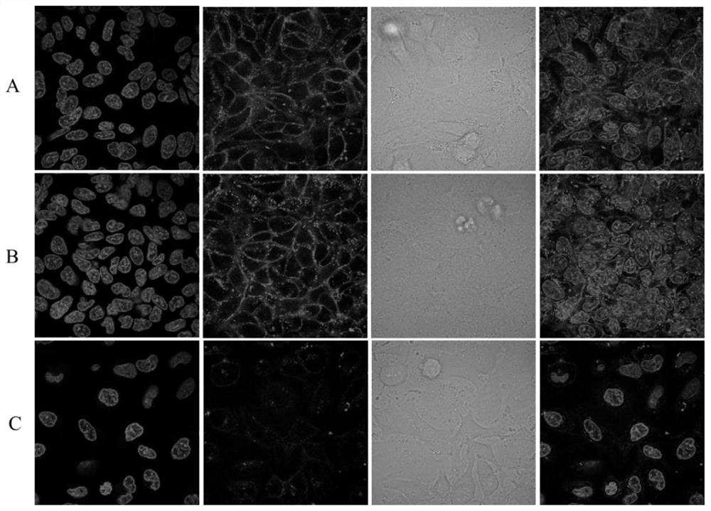 N-azidoacetyl-d-mannosamine derivatives and their preparation methods and applications in the detection of nitroreductase