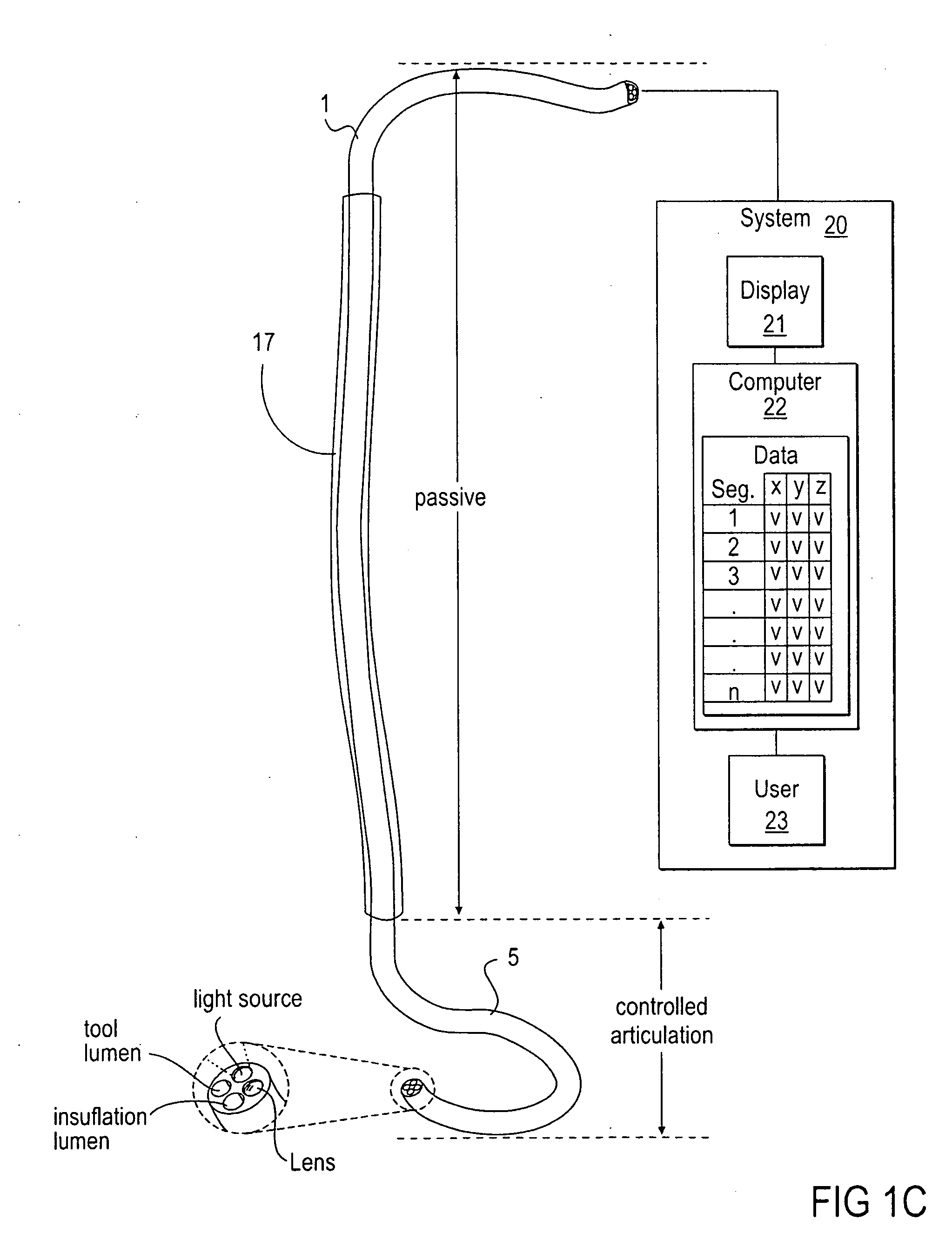 Methods and apparatus for performing transluminal and other procedures