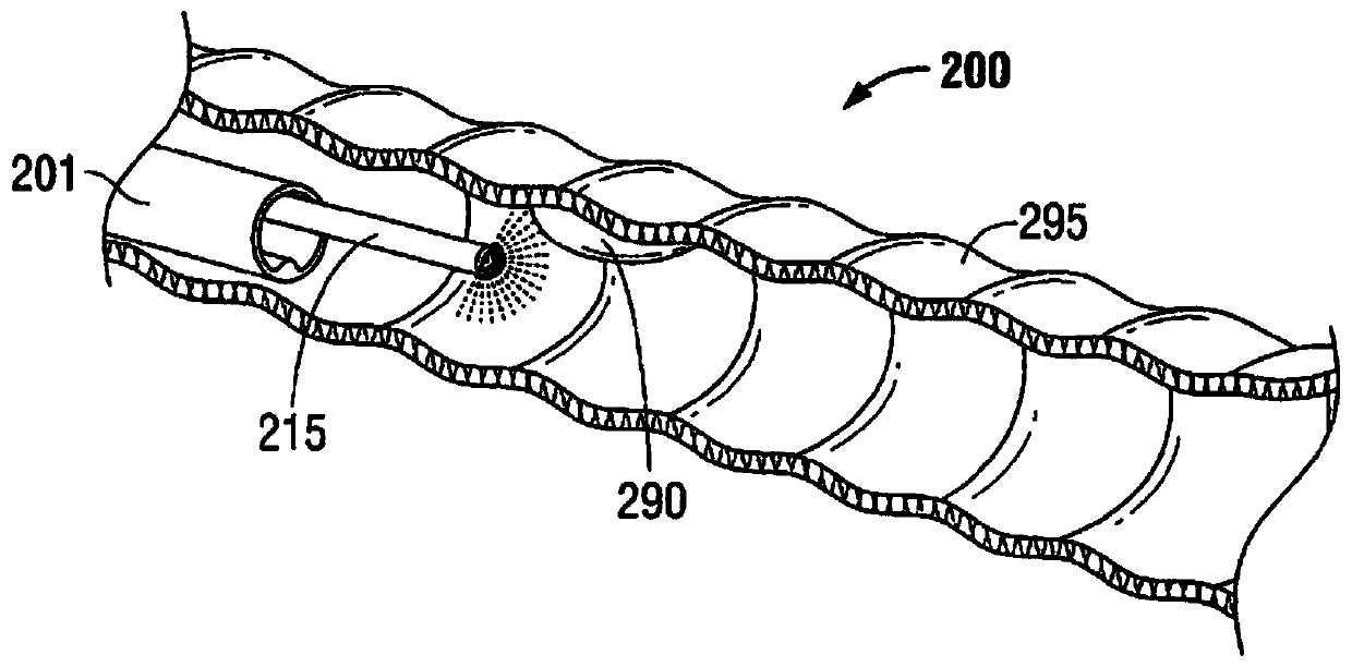 System for minimally-invasive, operative gastrointestinal treatment